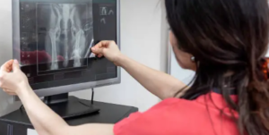 best therapy for dogs with hip dysplasia